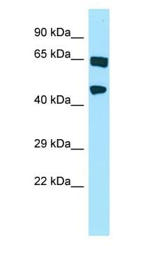 HABP4 Antibody (aa65-114)
