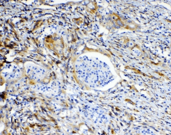 Polyclonal Rabbit anti-Human ABCC2 / MRP2 Antibody (IHC, WB)