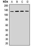 HIP1R Antibody