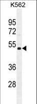 NUDT19 Antibody (aa153-181)