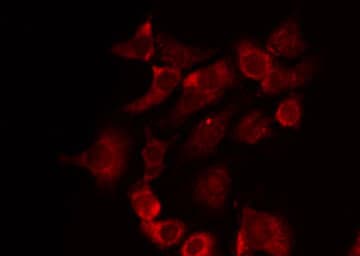 Polyclonal Rabbit anti-Human BRI3BP Antibody (IHC, IF, WB)