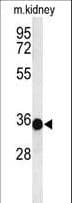 Polyclonal Rabbit anti-Human Prohibitin 2 / PHB2 Antibody (Tyr248, IHC, WB)