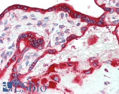 IHC-plus™ Polyclonal Rabbit anti-Human PTGER2 / EP2 Antibody (IHC, WB)