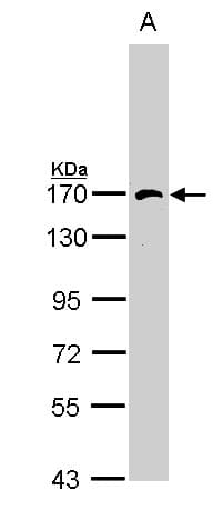 Polyclonal Rabbit anti-Human AP3B1 Antibody (WB)