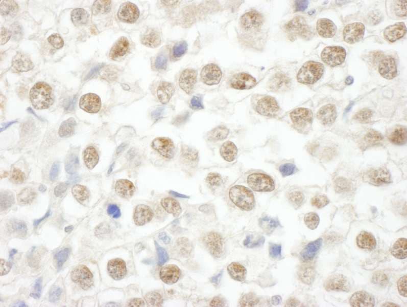 ARID2 Antibody (aa1785-1835)
