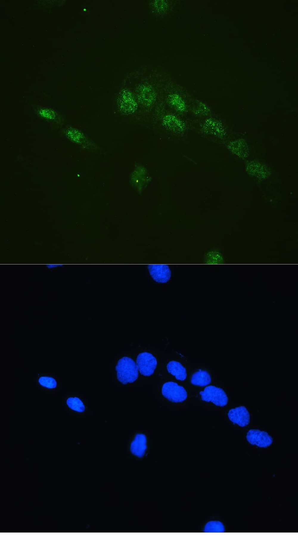 CBFB Antibody