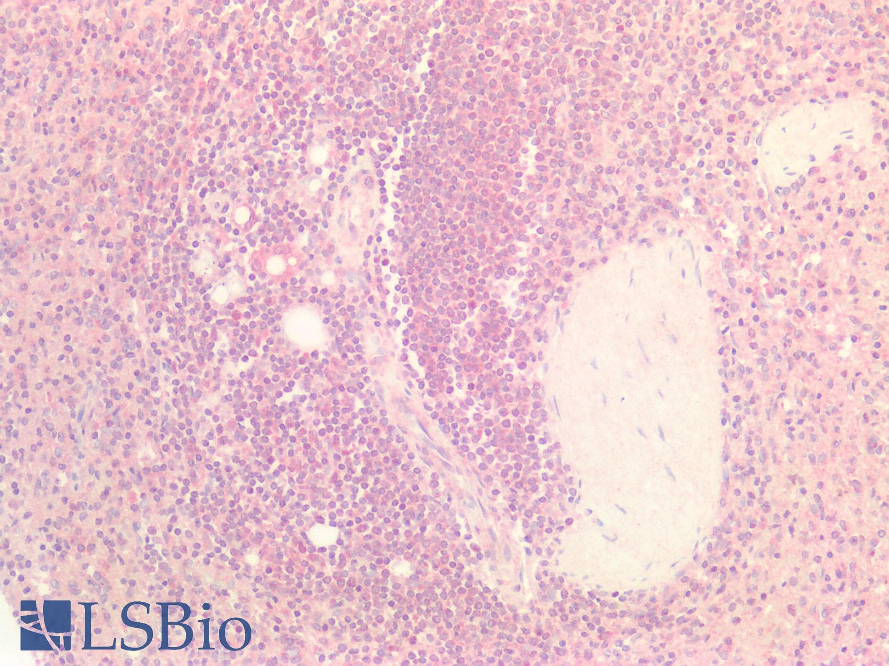 IHC-plus™ FEN1 Antibody (aa117-380, clone OTI1E1)