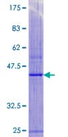 Human MPV17 Protein (Recombinant GST)