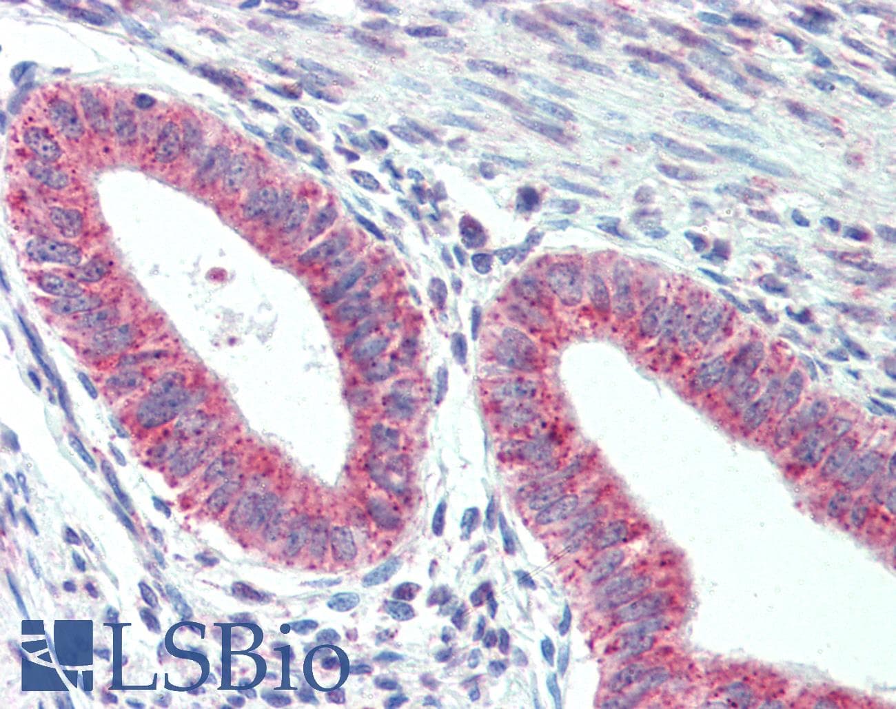 IHC-plus™ Polyclonal Rabbit anti-Human TM9SF1 Antibody (Internal, IHC)