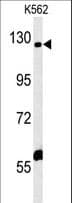 Polyclonal Rabbit anti-Human IQSEC3 Antibody (aa24-52, WB)