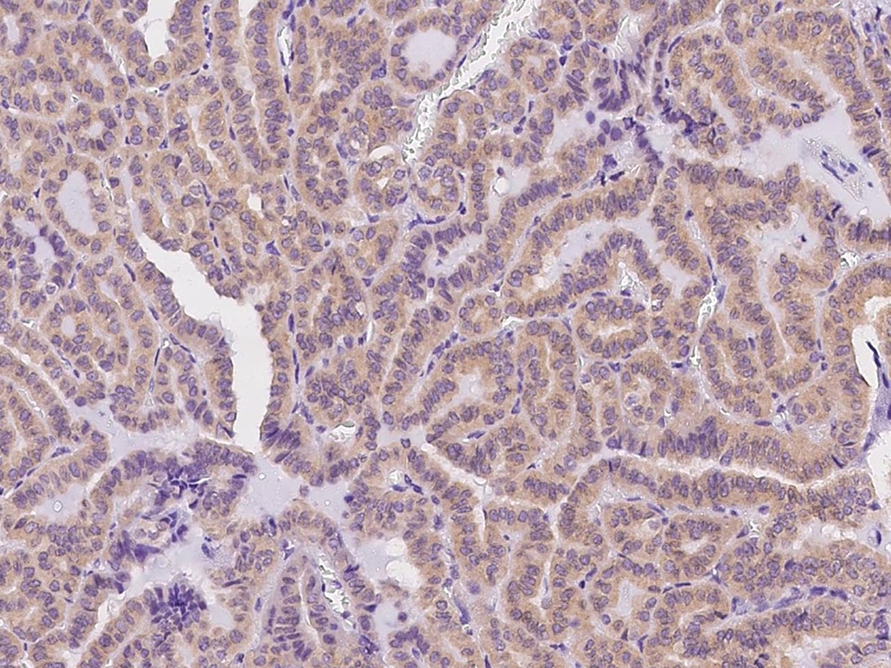 DERL2 / Derlin-2 Antibody