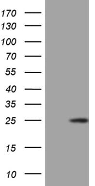 CSF3 / G-CSF Antibody (clone OTI1G6)