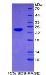 Human APOF / Apolipoprotein F (Recombinant His-T7)