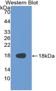 SVIL / Supervillin Antibody (aa1385-1525)