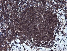 RAB37 Antibody (clone OTI2F1)