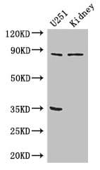 Polyclonal Rabbit anti-Human RPS6KA4 / MSK2 / RSK-B Antibody (IF, WB)