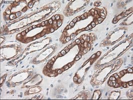 KRT18 / CK18 / Cytokeratin 18 Antibody (clone OTI1E1)