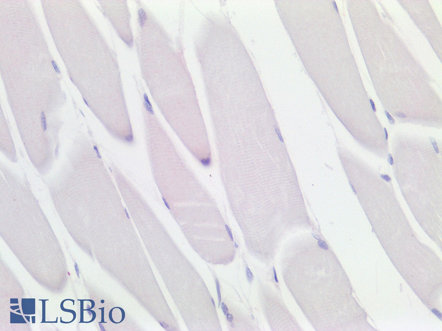 PathPlus™ ITGAX / CD11c Antibody (Internal)