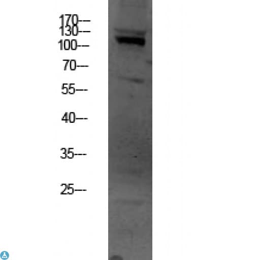 OGT / O-GLCNAC Antibody
