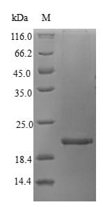 Atlantic salmon Vertebrate ancient opsin Protein (Recombinant 6His-B2M, N-terminus)
