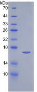 Human IL2 Protein (Recombinant His)