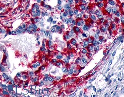 PathPlus™ ADGRD1 / GPR133 Antibody (N-Terminus)