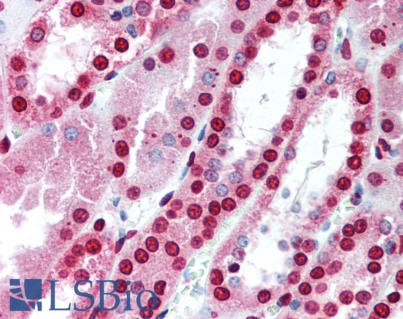 IHC-plus™ MBD3 Antibody (aa215-230, clone 106B691)
