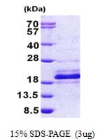 Human DNAJC24 Protein (Recombinant His)