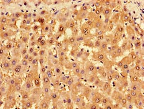 TROVE2 Antibody