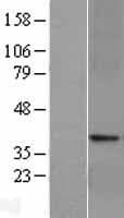 GLP1R / GLP-1 Receptor Protein (Over-Expression Lysate Myc-DDK (Flag))