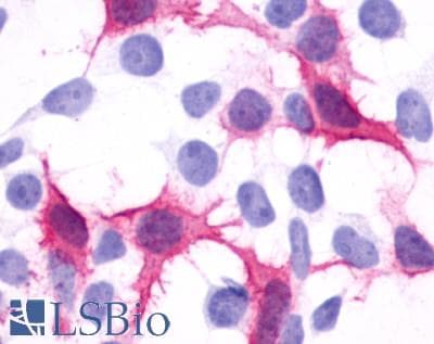 IHC-plus™ CXCR1 Antibody (N-Terminus)