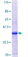 Human WBP2 Protein (Recombinant GST, N-terminus)