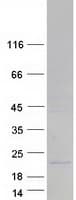 Human MRPL11 Protein (Recombinant Myc-DDK (Flag))