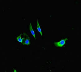 Polyclonal Rabbit anti-Human FcERI / Fc Epsilon RI Antibody (IHC, IF, WB)