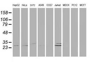 DCK / Deoxycytidine kinase Antibody (clone OTI16G6, Carrier-free)