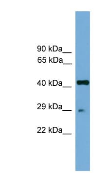 Polyclonal Rabbit anti-Mouse RFXAP Antibody (aa101-150, WB)