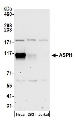 Junctin / ASPH Antibody (aa708-758)