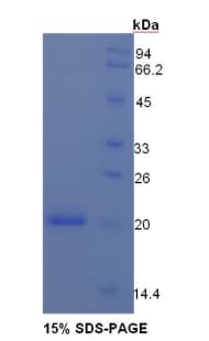 Mouse ANGPT1 / Angiopoietin-1 Protein (Recombinant His)