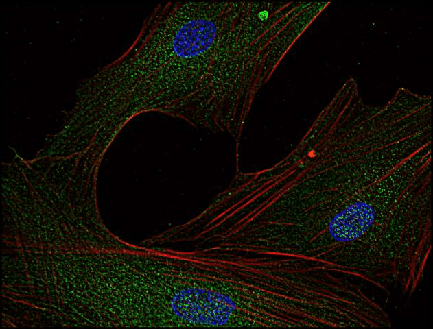 IHC-plus™ Monoclonal Mouse anti-Human SYN / FYN Antibody (clone FYN-01, aa7-176, IHC, WB)