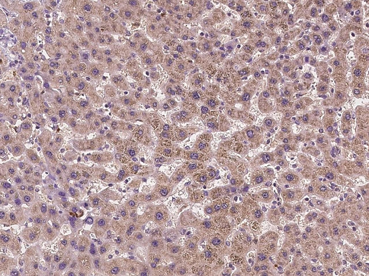 ADGRE3 / EMR3 Antibody