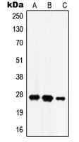 HSD17B10 / HADH2 Antibody (Internal)