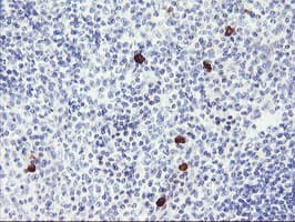 RPS6KB1 / P70S6K / S6K Antibody (clone OTI6B2)