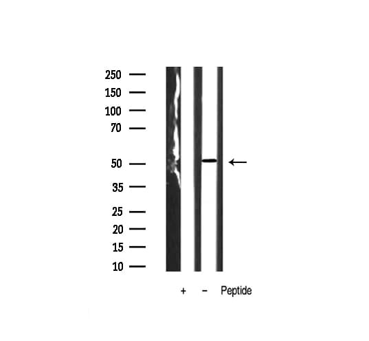 Polyclonal Rabbit anti-Human CAMK2A / CaMKII Alpha Antibody (IHC, IF, WB)
