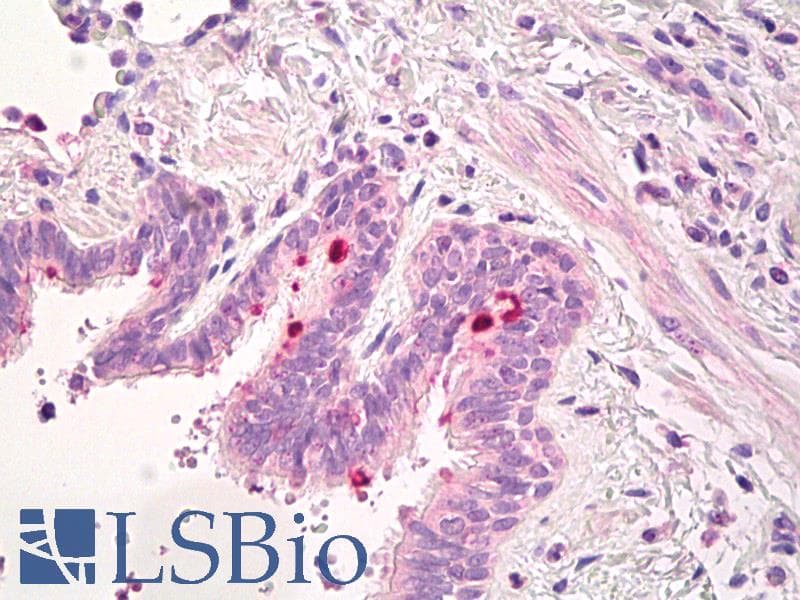 IHC-plus™ Monoclonal Mouse anti-Human ADGRE2 / EMR2 Antibody (IHC, WB)