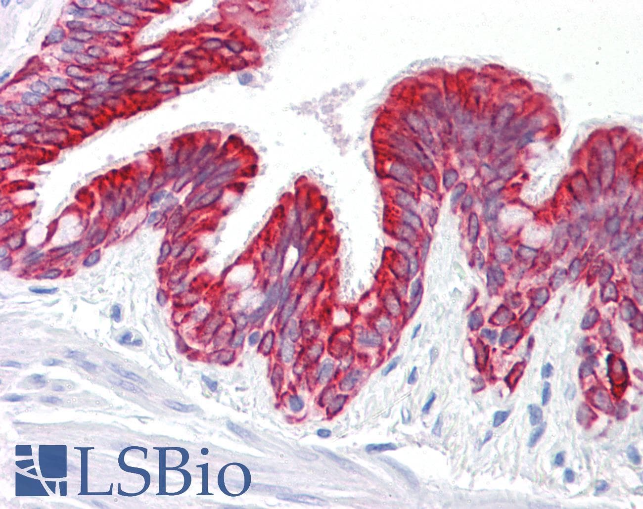 IHC-plus™ Cytokeratin 5+8 Antibody (clone RCK102)