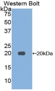 FURIN Antibody (aa418-573)