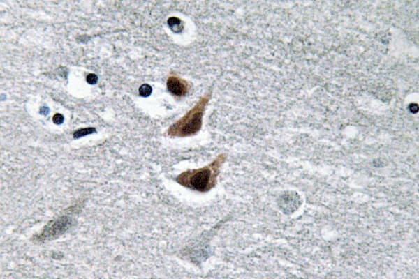 NME1 / NM23 Antibody (Tyr52)