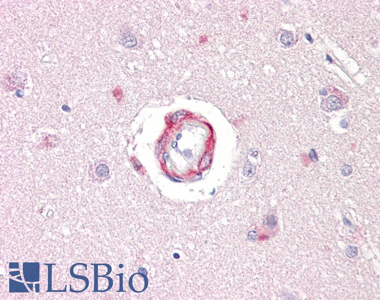 IHC-plus™ RPS6KB1 / P70S6K / S6K Antibody (aa337-386)