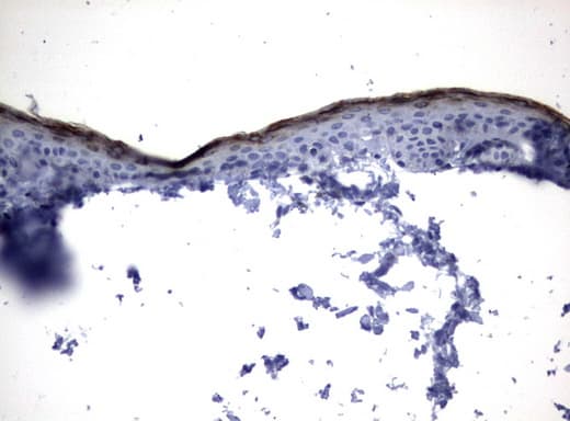 KLK8 / Kallikrein 8 Antibody (clone UMAB84)