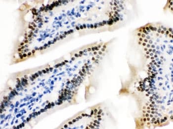 Polyclonal Rabbit anti-Mouse ZBTB7A / Pokemon Antibody (IHC, WB)